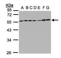 Invitrogen CaMKI gamma Polyclonal Antibody 100 &mu;L; Unconjugated:Antibodies,