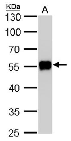 Invitrogen CaMKI gamma Polyclonal Antibody 100 &mu;L; Unconjugated:Antibodies,