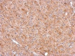 Invitrogen RIOK3 Polyclonal Antibody 100 &mu;L; Unconjugated:Antibodies,