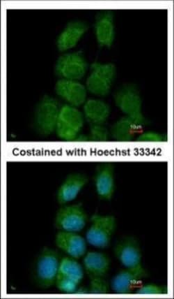 Invitrogen MAPK15 Polyclonal Antibody 100 &mu;L; Unconjugated:Antibodies,