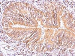 Invitrogen MAPK15 Polyclonal Antibody 100 &mu;L; Unconjugated:Antibodies,