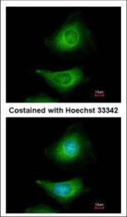 Invitrogen MEK3 Polyclonal Antibody 100 &mu;L | Buy Online | Invitrogen&trade; | Fisher Scientific