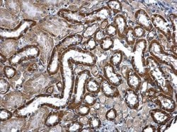 Invitrogen MEK3 Polyclonal Antibody 100 &mu;L; Unconjugated:Antibodies,