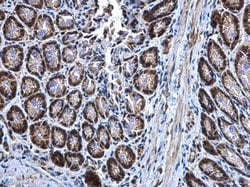 Invitrogen MEK3 Polyclonal Antibody 100 &mu;L; Unconjugated:Antibodies,