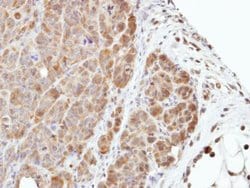 Invitrogen MEK3 Polyclonal Antibody 100 &mu;L; Unconjugated:Antibodies,