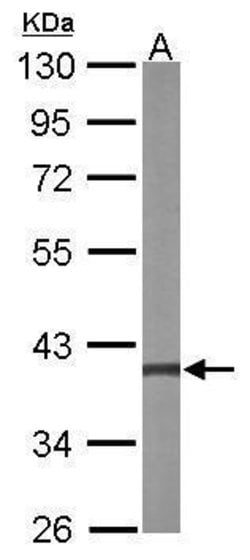 Invitrogen MEK3 Polyclonal Antibody 100 &mu;L; Unconjugated:Antibodies,