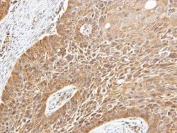 Invitrogen STK32B Polyclonal Antibody 100 &mu;L; Unconjugated:Antibodies,