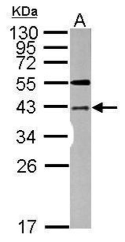 Invitrogen LYK5 Polyclonal Antibody 100 &mu;L; Unconjugated:Antibodies,