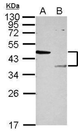 Invitrogen LYK5 Polyclonal Antibody 100 &mu;L; Unconjugated:Antibodies,