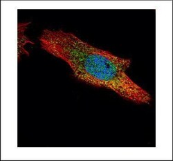 Invitrogen p70 S6 Kinase Polyclonal Antibody 100 &mu;L; Unconjugated:Antibodies,