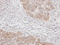 Invitrogen p70 S6 Kinase Polyclonal Antibody 100 &mu;L; Unconjugated:Antibodies,