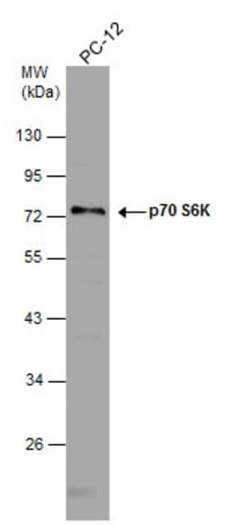 Invitrogen p70 S6 Kinase Polyclonal Antibody 100 &mu;L; Unconjugated:Antibodies,