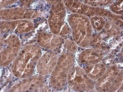 Invitrogen p70 S6 Kinase Polyclonal Antibody 100 &mu;L; Unconjugated:Antibodies,