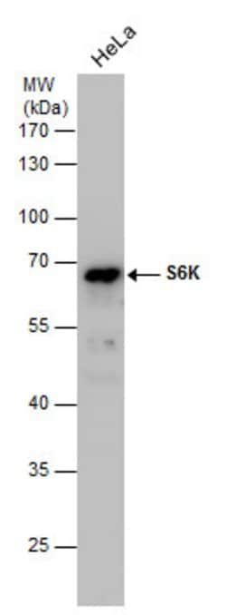 Invitrogen p70 S6 Kinase Polyclonal Antibody 100 &mu;L; Unconjugated:Antibodies,