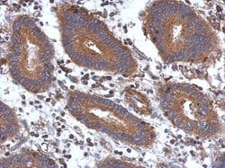 Invitrogen STK16 Polyclonal Antibody 100 &mu;L; Unconjugated:Antibodies,
