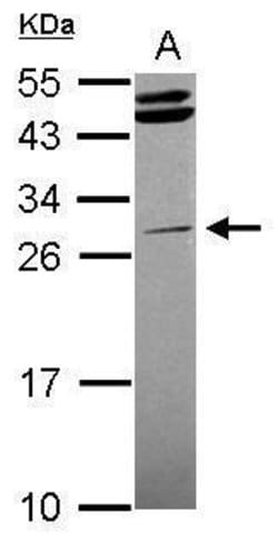 Invitrogen STK16 Polyclonal Antibody 100 &mu;L; Unconjugated:Antibodies,