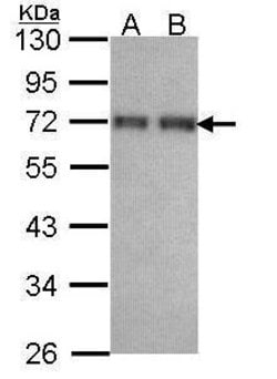 Invitrogen CCDC6 Polyclonal Antibody 100 &mu;L; Unconjugated:Antibodies,