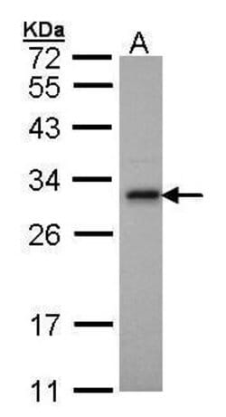 Invitrogen Adenylate Kinase 2 Polyclonal Antibody 100 &mu;L; Unconjugated:Antibodies,