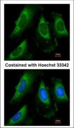 Invitrogen PGK1 Polyclonal Antibody 100 &mu;L; Unconjugated:Antibodies,