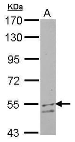 Invitrogen UGP2 Polyclonal Antibody 100 &mu;L; Unconjugated:Antibodies,