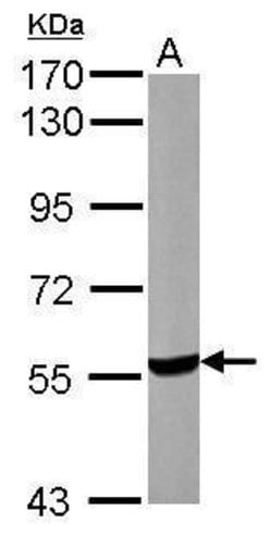 Invitrogen UGP2 Polyclonal Antibody 100 &mu;L; Unconjugated:Antibodies,