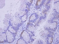 Invitrogen CoA Synthase Polyclonal Antibody 100 &mu;L; Unconjugated:Antibodies,