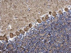Invitrogen PKC gamma Polyclonal Antibody 100 μL; Unconjugated:Antibodies,