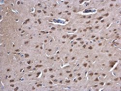 Invitrogen PKC gamma Polyclonal Antibody 100 μL; Unconjugated:Antibodies,