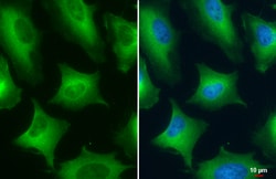 Invitrogen PKM2 Polyclonal Antibody 100 &mu;L; Unconjugated:Antibodies,