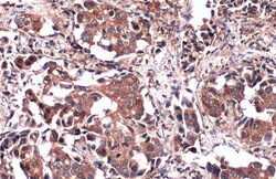 Invitrogen PKM2 Polyclonal Antibody 100 &mu;L; Unconjugated:Antibodies,