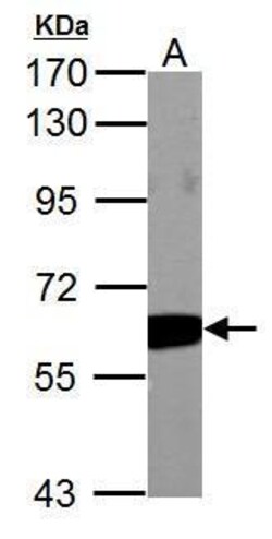 Invitrogen PKM2 Polyclonal Antibody 100 &mu;L; Unconjugated:Antibodies,