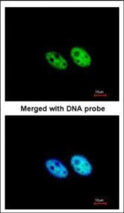 Invitrogen SART3 Polyclonal Antibody 100 &mu;L; Unconjugated:Antibodies,