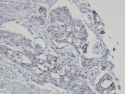 Invitrogen SART3 Polyclonal Antibody 100 &mu;L; Unconjugated:Antibodies,