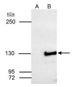 Invitrogen SART3 Polyclonal Antibody 100 &mu;L; Unconjugated:Antibodies,