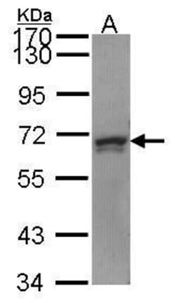Invitrogen PRPF31 Polyclonal Antibody 100 &mu;L; Unconjugated:Antibodies,
