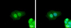 Invitrogen ZNF703 Polyclonal Antibody 100 μL; Unconjugated:Antibodies,
