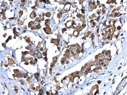 Invitrogen ZNF703 Polyclonal Antibody 100 μL; Unconjugated:Antibodies,