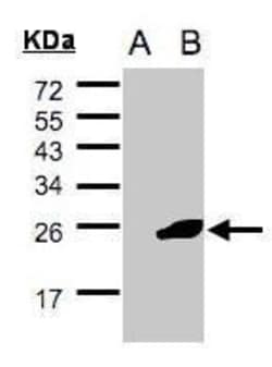 Invitrogen NCE2 Polyclonal Antibody 100 μL; Unconjugated:Antibodies,