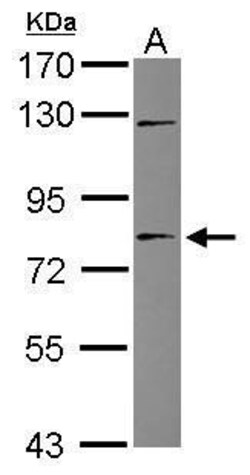 Invitrogen TIGD1 Polyclonal Antibody 100 &mu;L | Buy Online | Invitrogen&trade; | Fisher Scientific