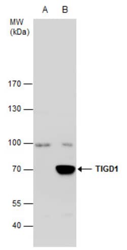 Invitrogen TIGD1 Polyclonal Antibody 100 &mu;L | Buy Online | Invitrogen&trade; | Fisher Scientific