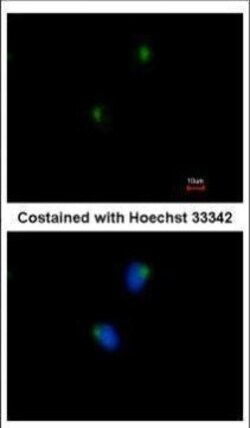 Invitrogen SLITRK1 Polyclonal Antibody 100 &mu;L; Unconjugated:Antibodies,
