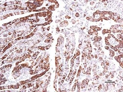 Invitrogen GPR30 Polyclonal Antibody 100 &mu;L | Buy Online | Invitrogen&trade; | Fisher Scientific