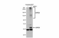 Invitrogen GPR30 Polyclonal Antibody 100 &mu;L | Buy Online | Invitrogen&trade; | Fisher Scientific
