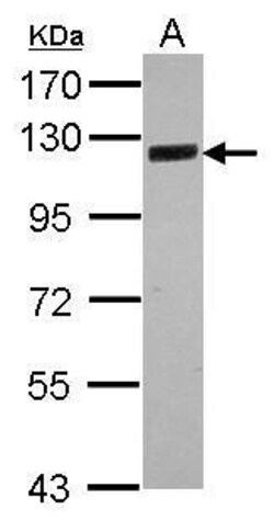 Invitrogen SRPK2 Polyclonal Antibody 100 &mu;L | Buy Online | Invitrogen&trade; | Fisher Scientific