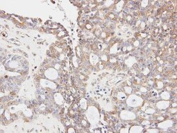 Invitrogen GLYCTK Polyclonal Antibody 100 &mu;L; Unconjugated:Antibodies,