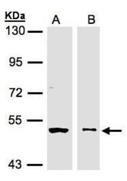 Invitrogen GLYCTK Polyclonal Antibody 100 &mu;L; Unconjugated:Antibodies,