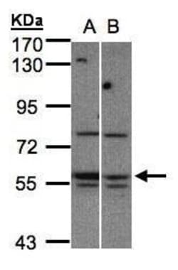 Invitrogen MST3 Polyclonal Antibody 100 &mu;L; Unconjugated:Antibodies,