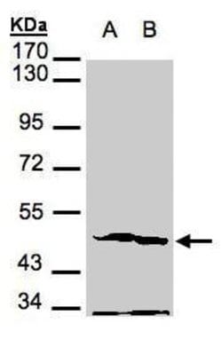 Invitrogen PGK2 Polyclonal Antibody 100 &mu;L; Unconjugated:Antibodies,