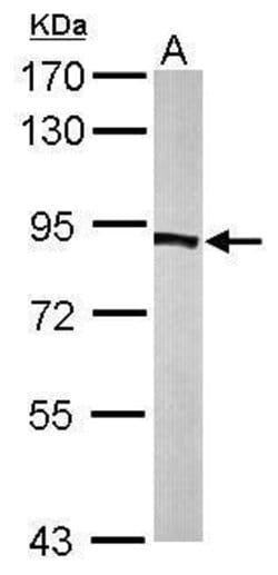 Invitrogen PFKP Polyclonal Antibody 100 &mu;L; Unconjugated:Antibodies,