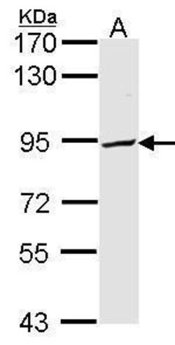 Invitrogen PFKP Polyclonal Antibody 100 &mu;L; Unconjugated:Antibodies,